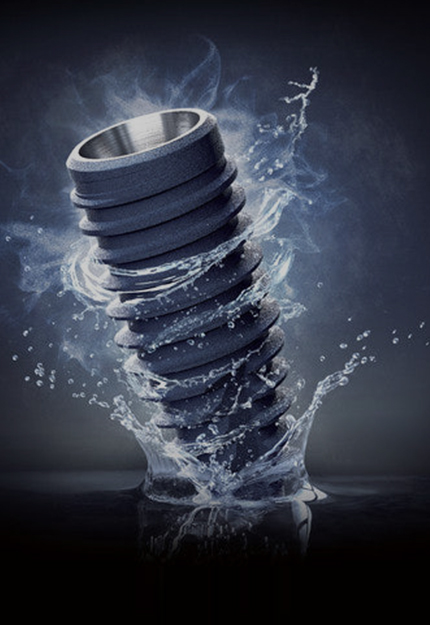 플라즈마 임플란트