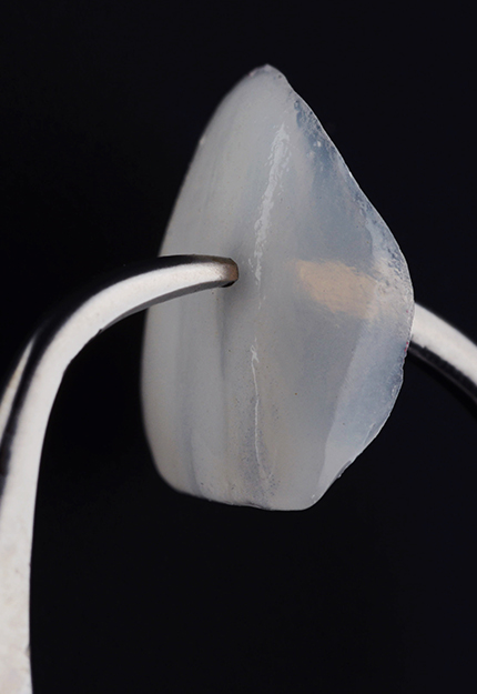 원데이 라미네이트